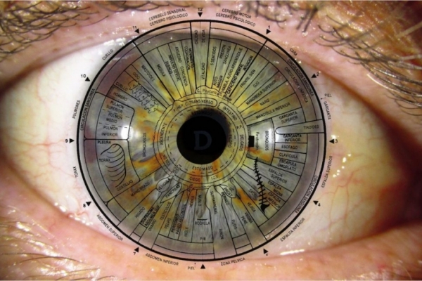 Iridologia