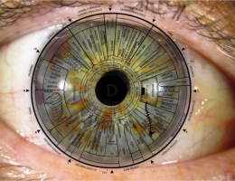 Iridologia